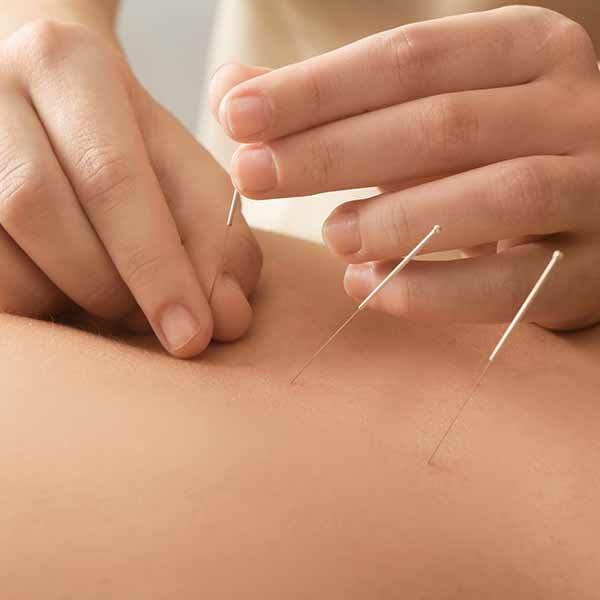 acupuncture (1)